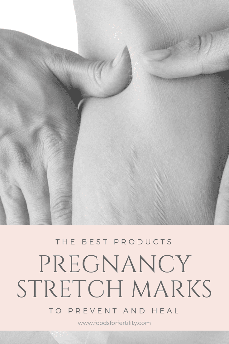 Pregnancy Stretch Marks – The Best Stretch Mark Prevention Products