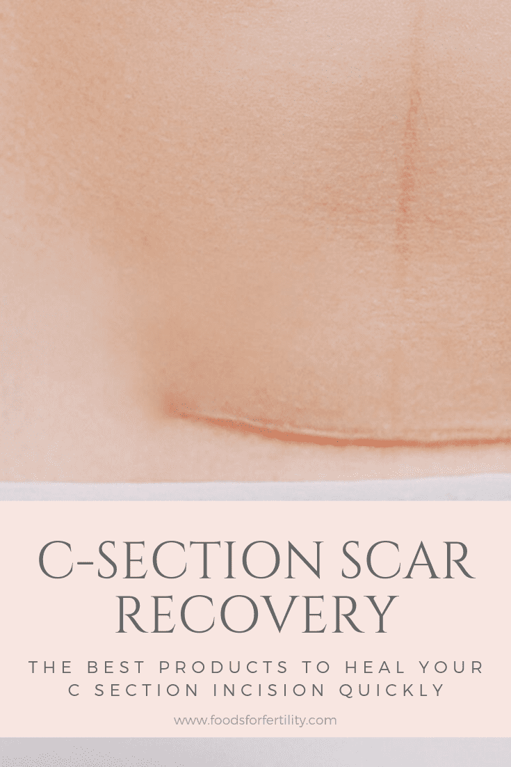 C Section Scar Recovery – How to Heal and Care for Your C Section Incision
